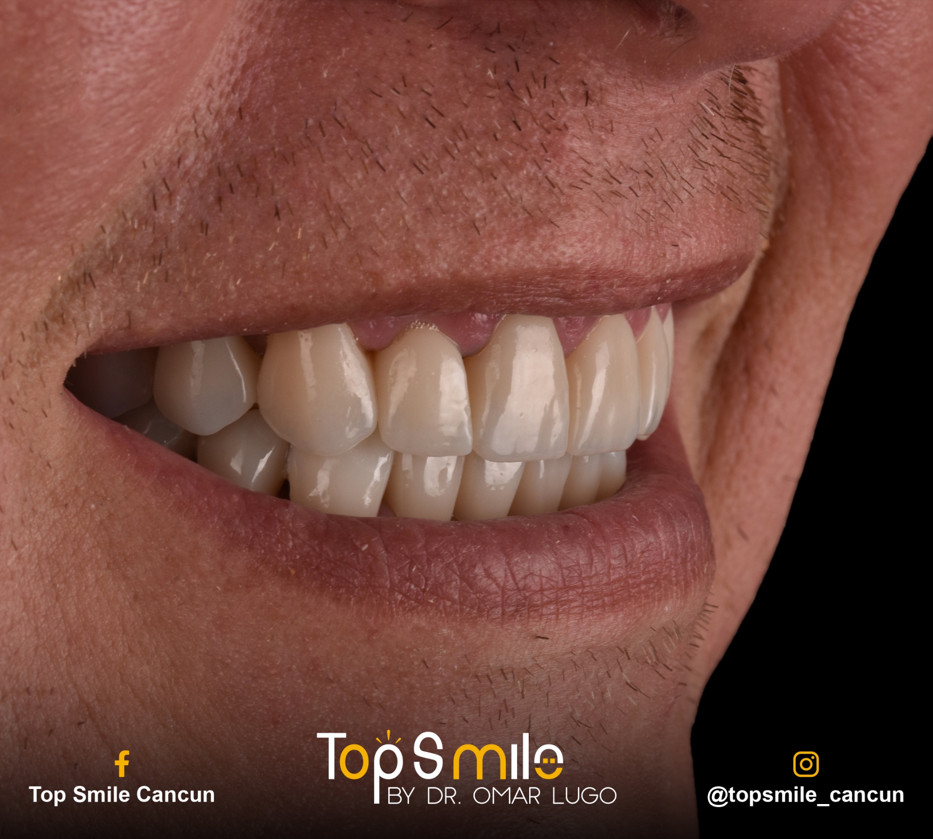 Higiene & Periodoncia